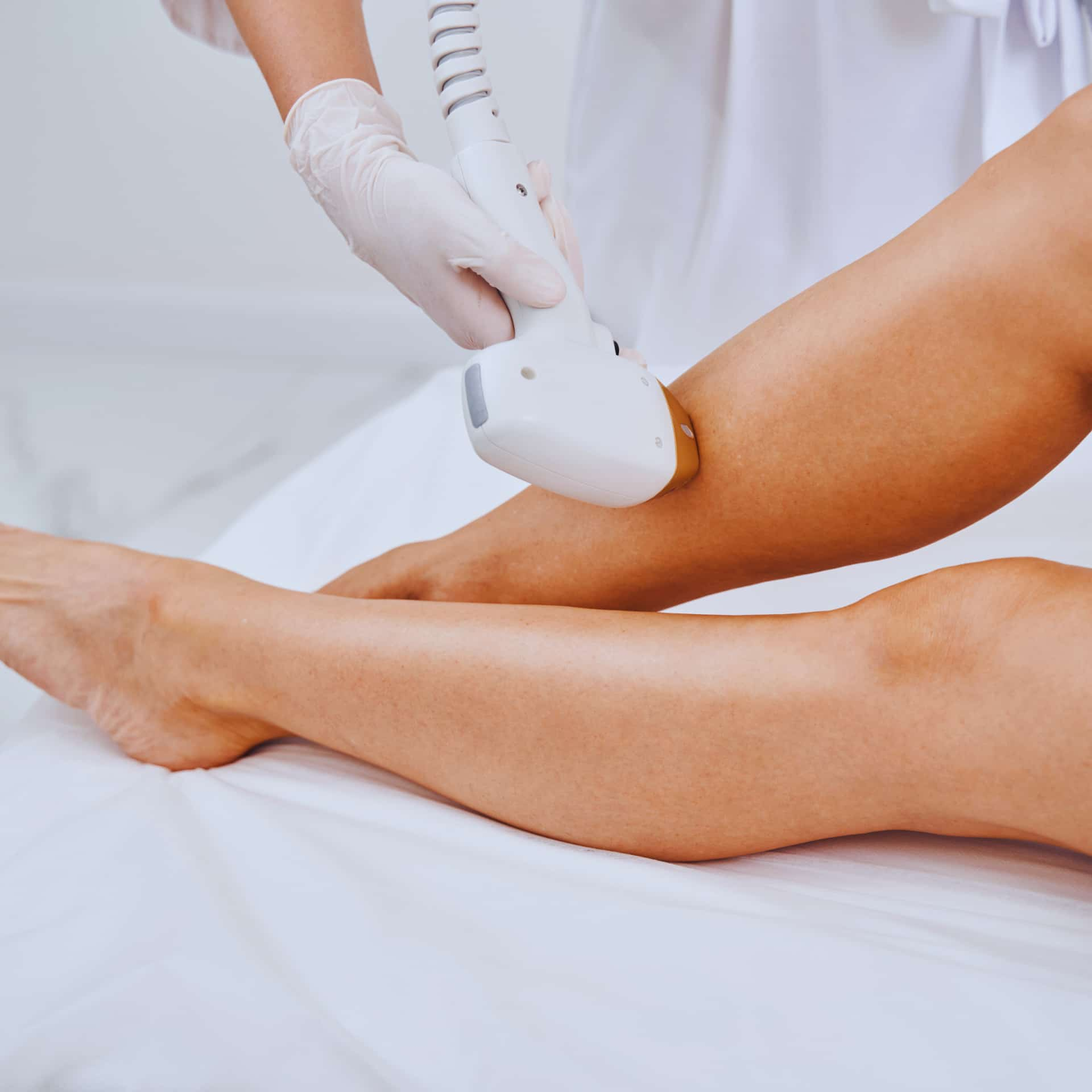 Laser Hair Removal Services